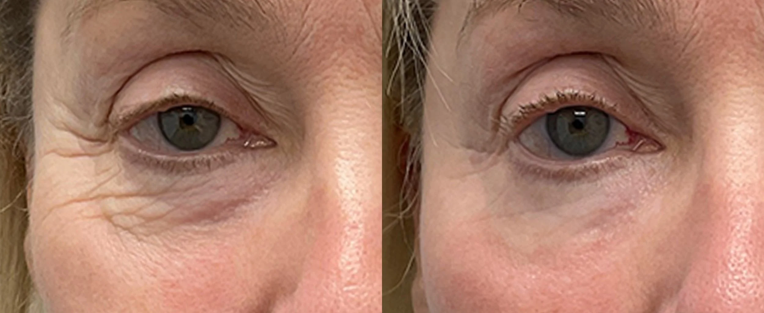 P1_SF_M8_Lum_Female_Face_Eye_RS-TM.jpg