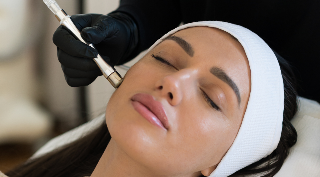 Microneedling.png