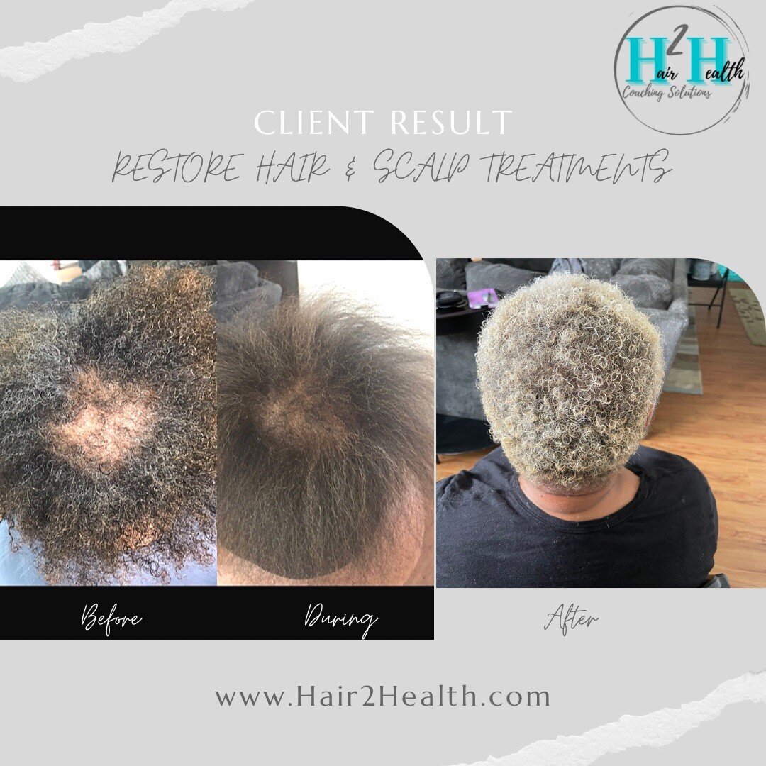 Restoration is possible if you attack the concern quickly and aggressively. Book with Coach Jhe to start your journey today. Ask the coach to help you become a better, stronger you, inside and out! #coachjhe #Hair2Health #jhethenaturalist #askthecoac