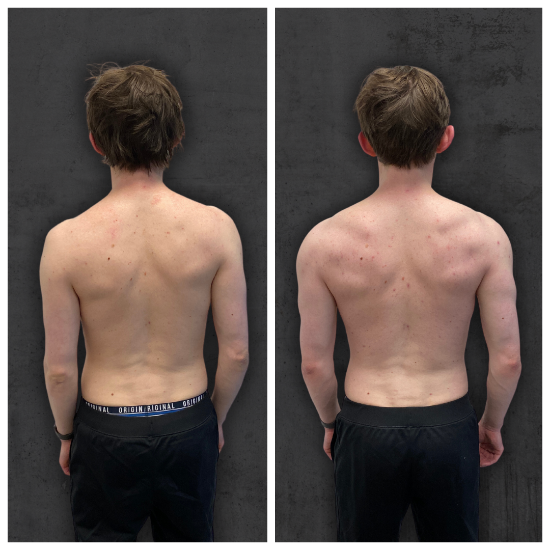 New Kieran Back.png