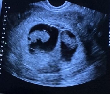 My Twin Boys