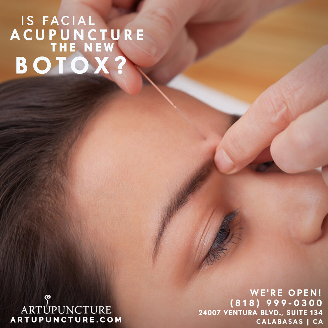 Artupuncture Facial Acupuncture 7-31.jpg