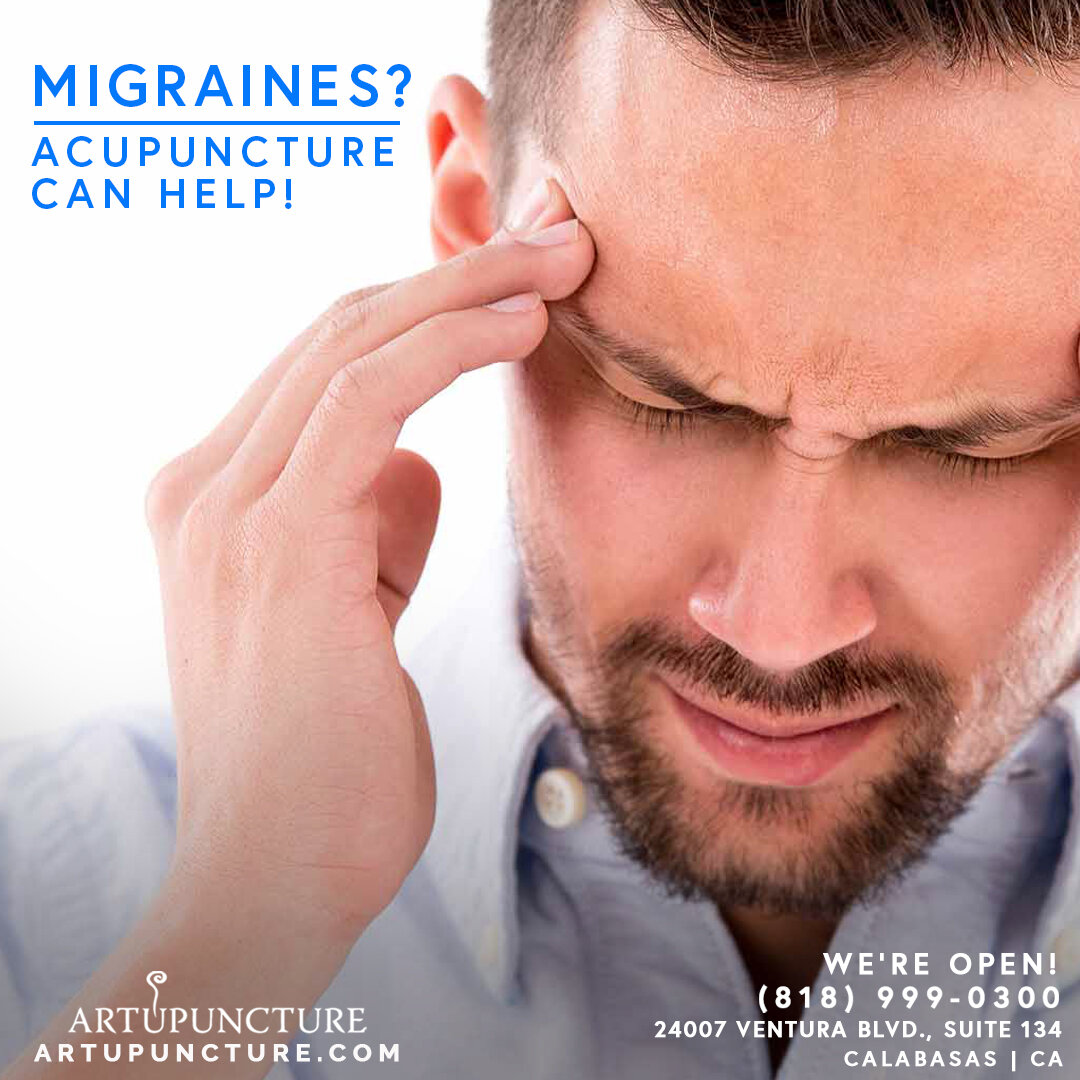 Artupuncture Migraines 7-28.jpg