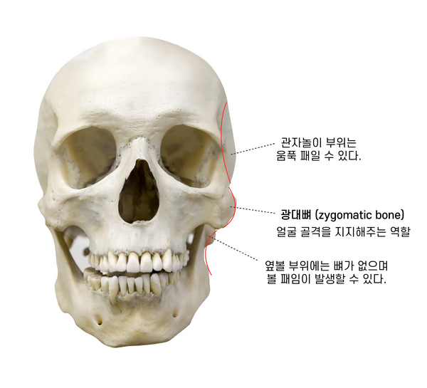 해골형, 땅콩형 얼굴 탈출에는 윤곽수술이 답일까? 해골형, 땅콩형 얼굴 탈출에는 윤곽수술이 답일까?