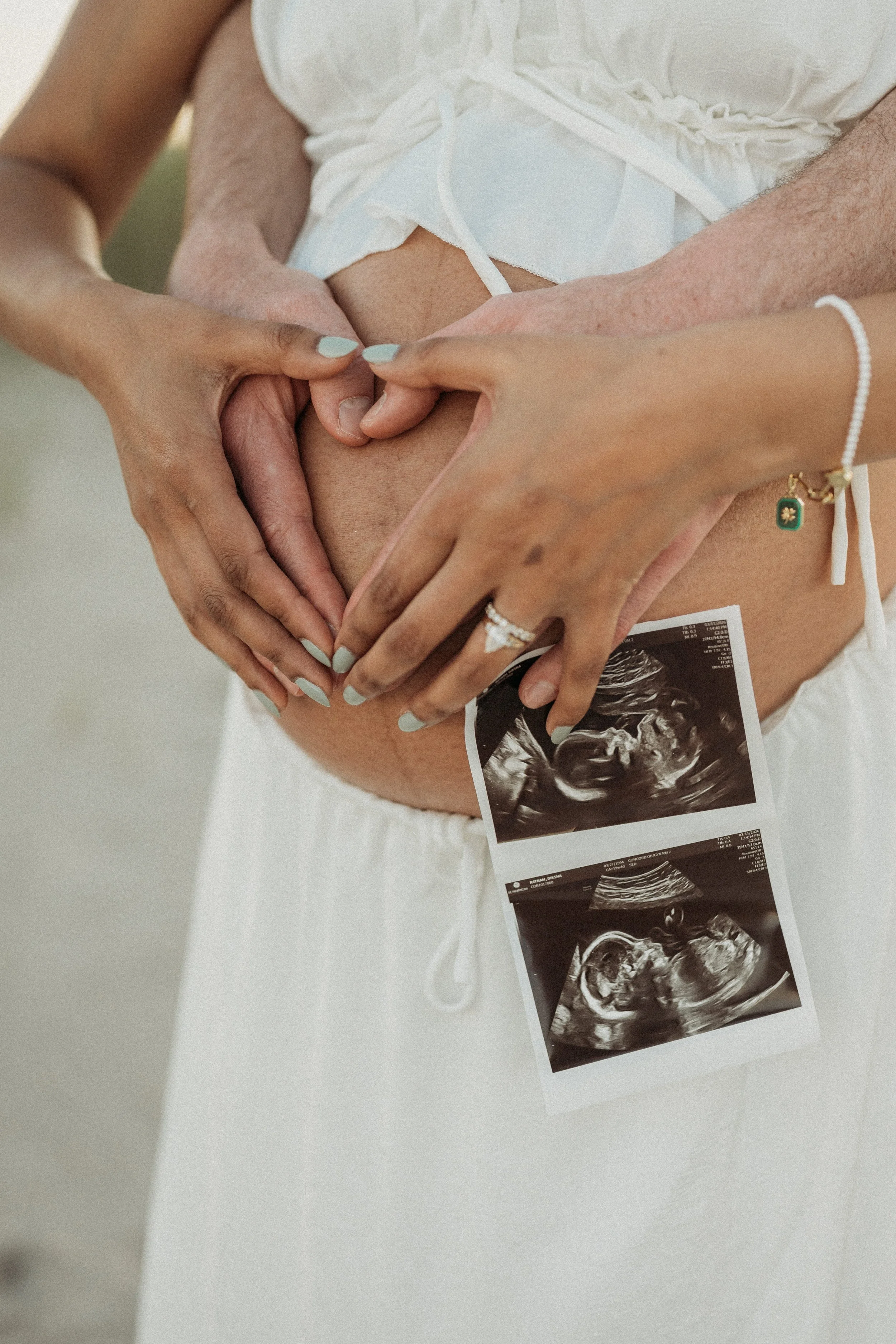 Couple holding an ultrasound photo