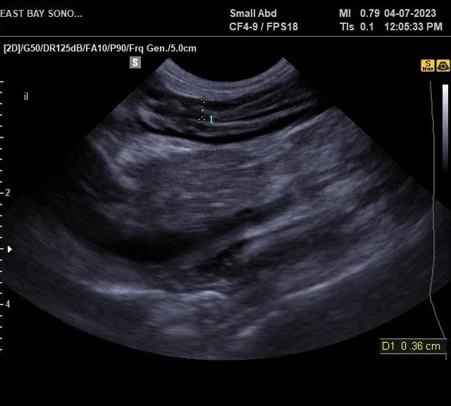 Inflammatory Bowel Disease in Cats — SCRIPTWORKS