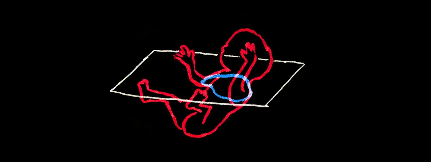 Echo Baby copy.jpg