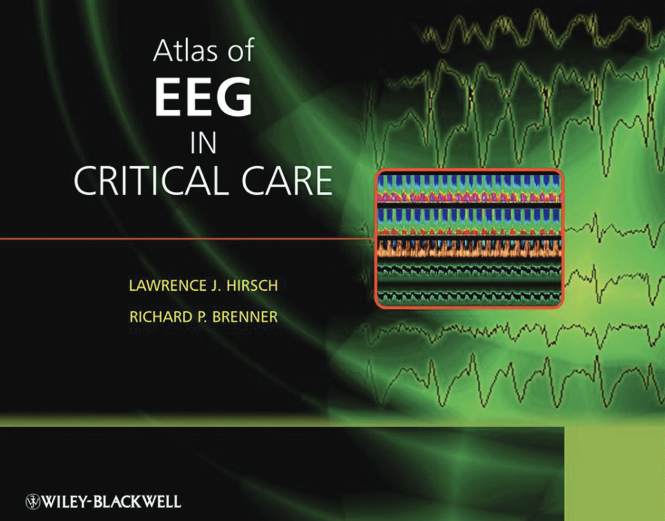 EEG en réa