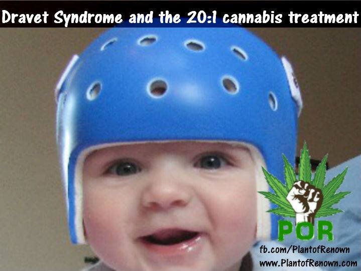 cannabis-dravet-syndrome.jpg