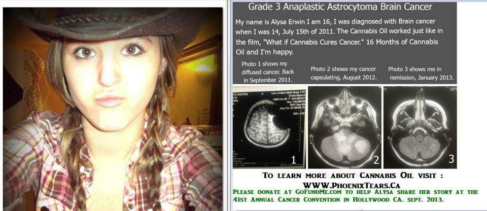 cannabis-oil-brain-cancer.jpg