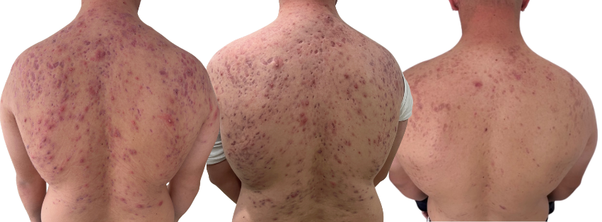 Copy of youtube banner (Facebook Cover) (12).png