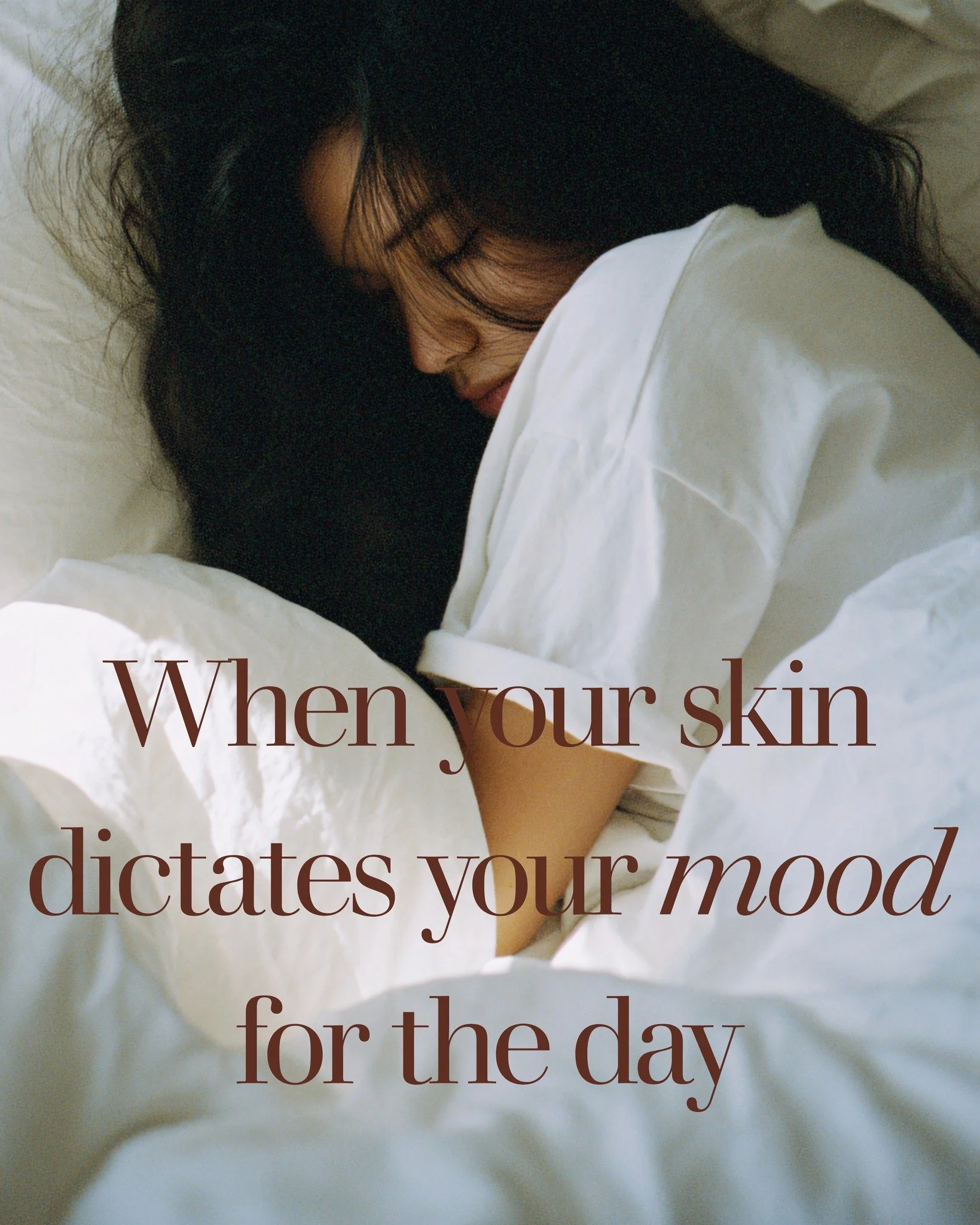 If your mood is dependent on your skin, then it's time to get some help.
So many of you avoid social events, relationships, sport.....
It doesn't need to be this way.

Check out our offerings and book yourself in.

 #skin #stressed #eczemahealing #Ec
