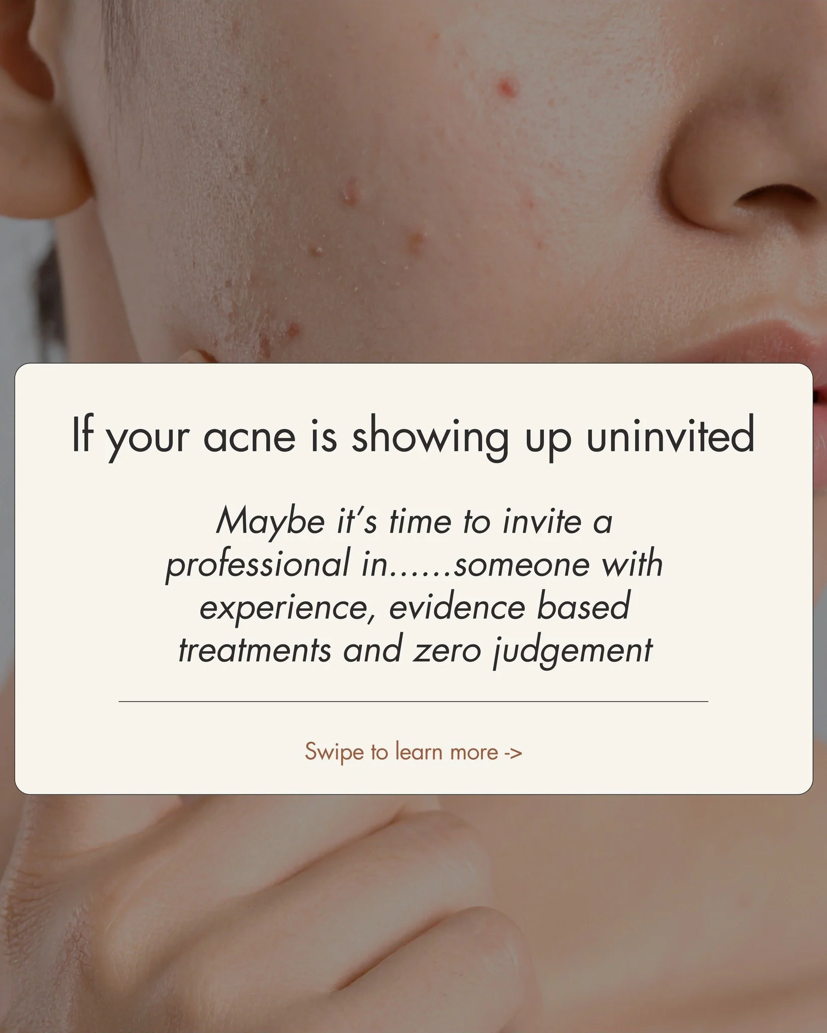 We know you've probs tried everything.
If you're stuck in a cycle of new skincare products, it gets a bit better, then it gets worse again, then you try something your boss told you about and nothing changes, then give us a call babe.

 #naturopath #