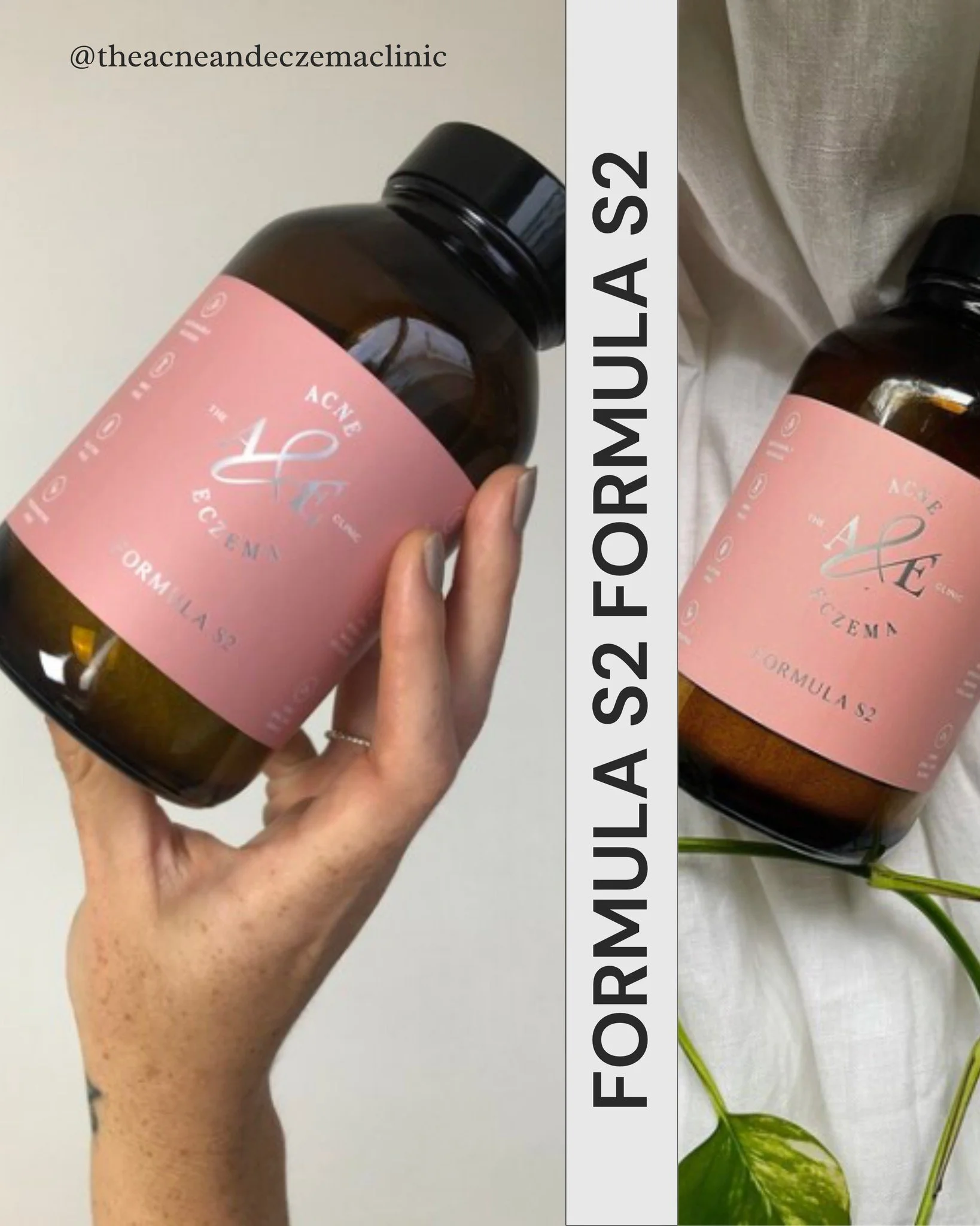 Designed out of clinical necessity, Formula S2 targets skin-specific nutrients in a safe and clinically effective dose, to improve problem skin from the foundations of the barrier and extracellular matrix. 
Formula S2 is aptly named as it&rsquo;s the