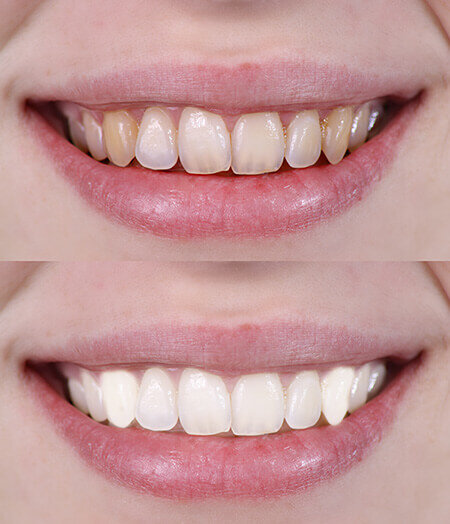 ogden-utah-dentist-smile-gallery01.jpg