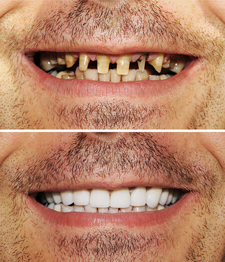 ogden-utah-dentist-smile-gallery02.jpg