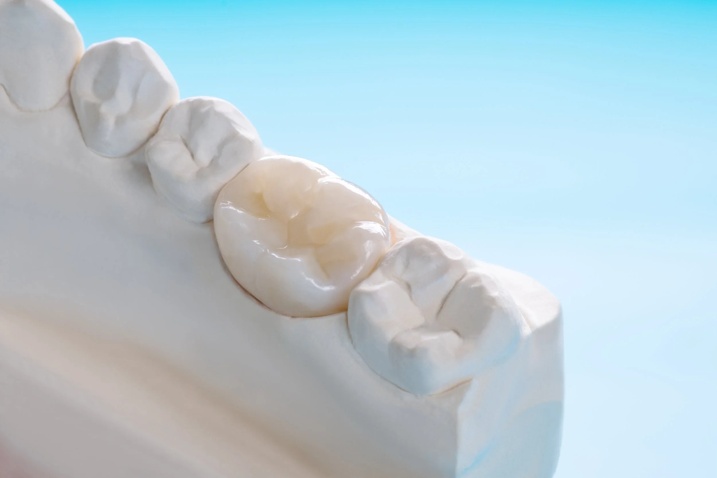 What materials are used to make dental crowns?