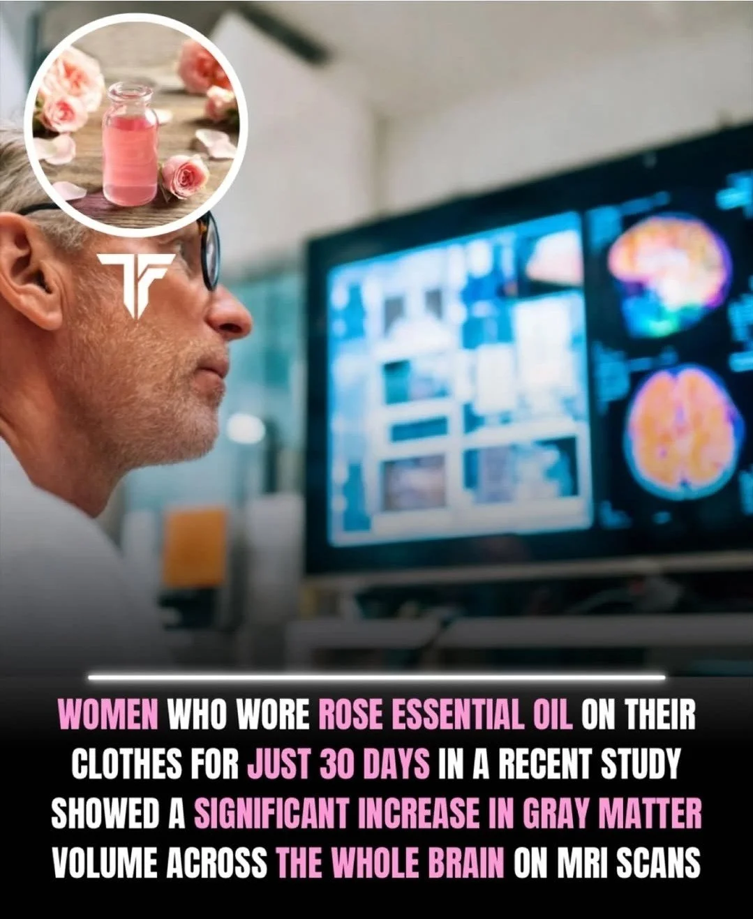 In a brand new study, researchers found that women who wore rose essential oil on their clothing for just 30 days had significant increases in gray matter volume across the whole brain on MRI scans.
When the aromatic molecules of rose essential oil