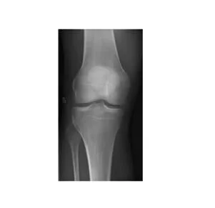 What's in an X-ray ? 