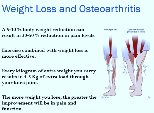 Why is Weight Loss in Osteoarthritis Important? 
