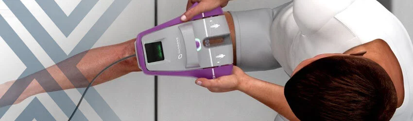 Precice Stryde System | LimbplastX Institute