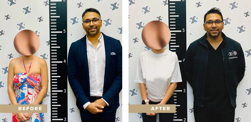 Female Patient Before and After