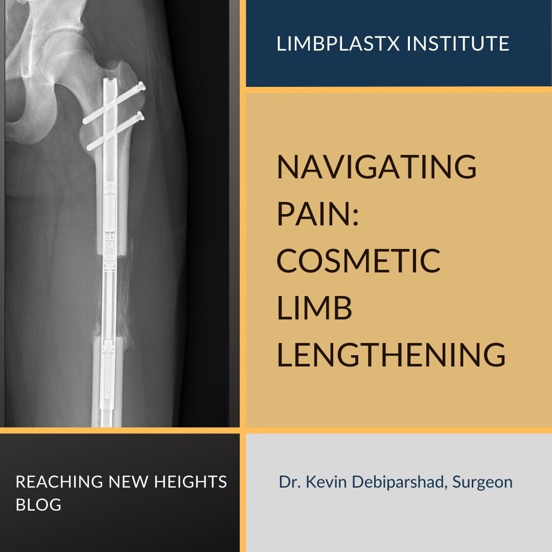 Check out our latest blog post detailing pain surrounding #limblengthening with insight to prepare, manage, and realize positive outcomes: https://www.limbplastx.com/height-blog/navigating-pain-cosmetic-leg-lengthening

Cosmetic limb lengthening a re