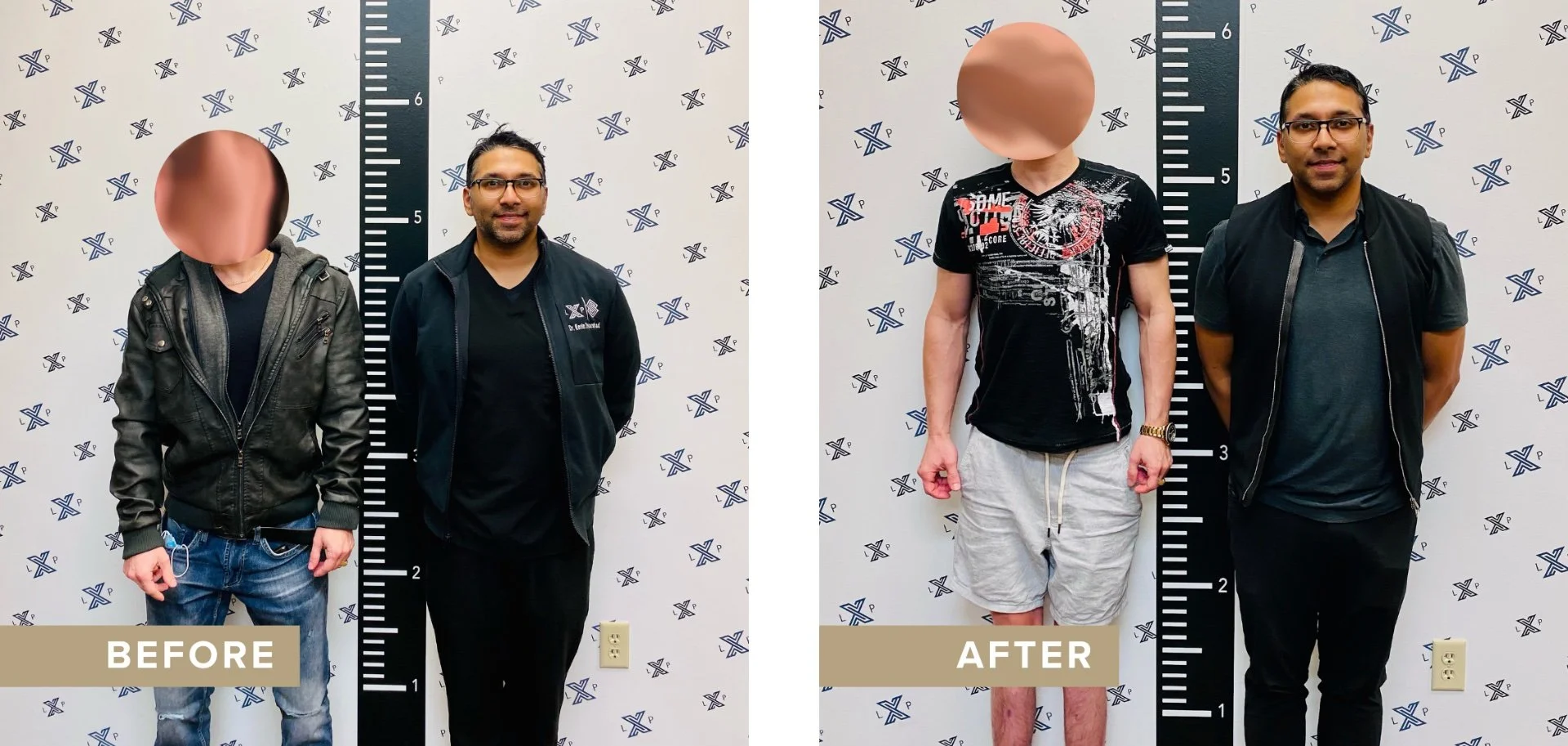 Male Patient Before and After