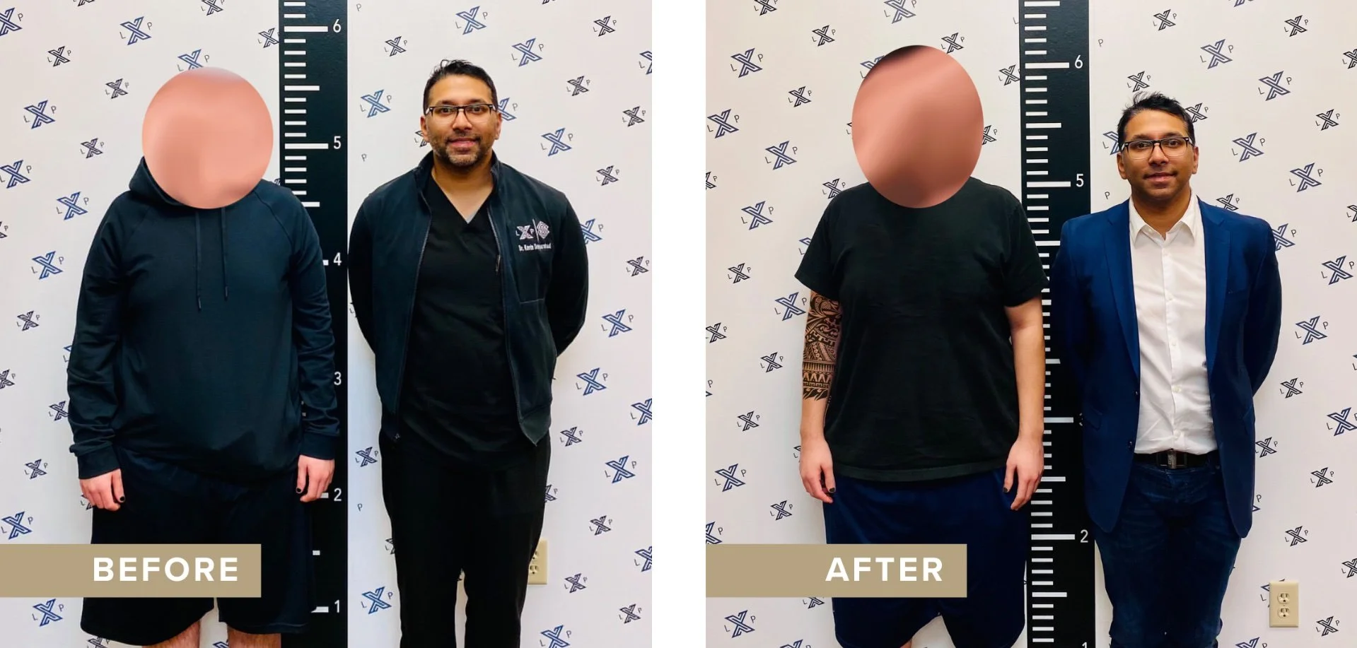 Patient Before and After