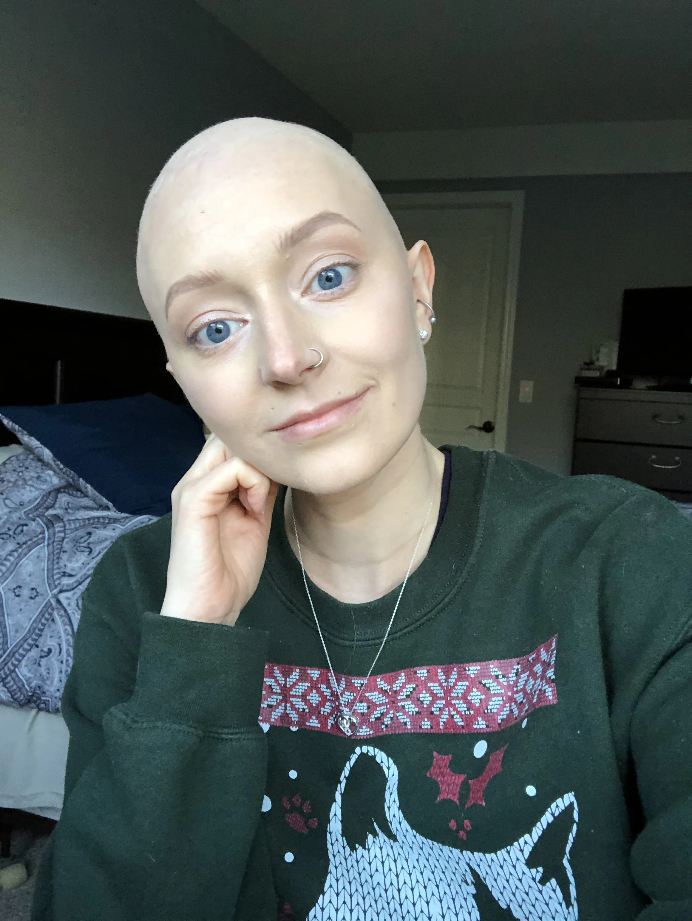 Steph-Bald.jpg