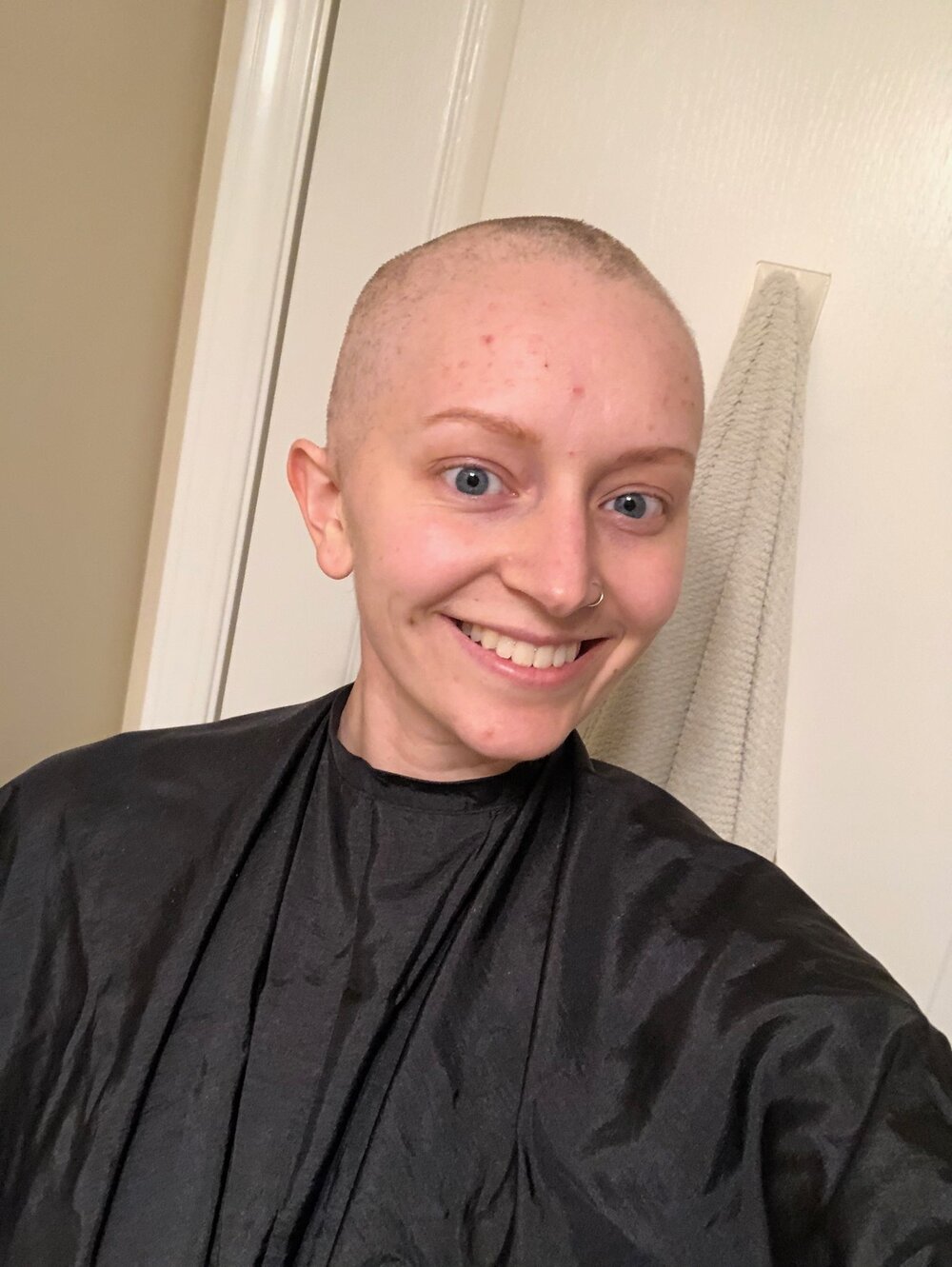 Chemo and Hair Loss — She Stays Strong