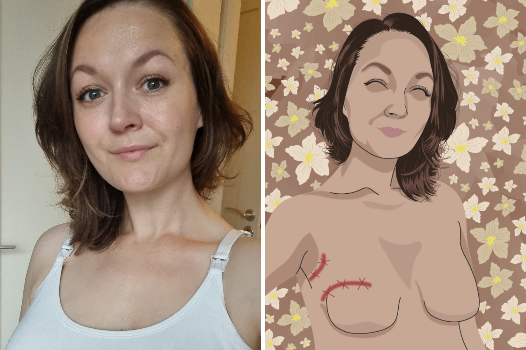Mastectomy Scar Art - Breast Cancer Survivors Heal through Digital  Portraits — She Stays Strong