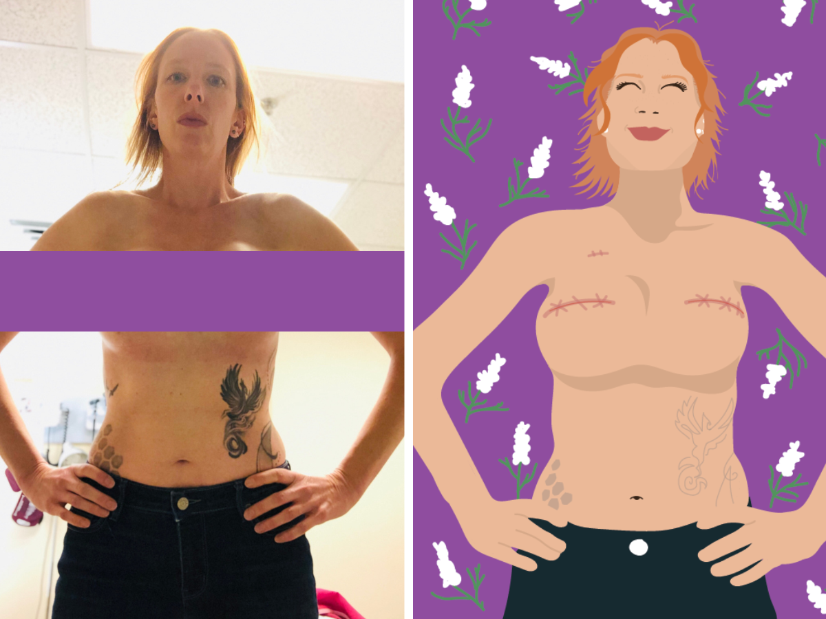 Mastectomy Scar Art - Breast Cancer Survivors Heal through Digital