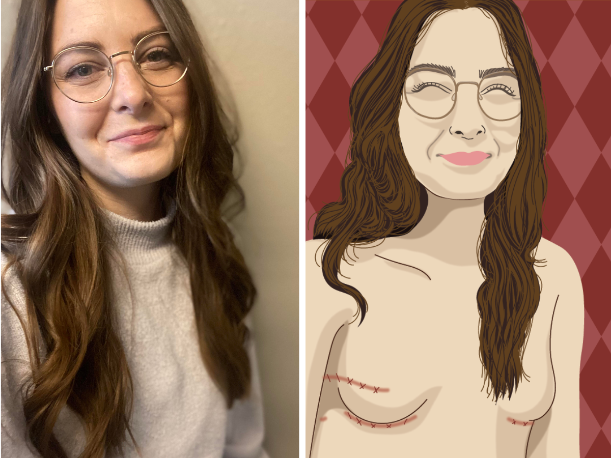 Mastectomy Scar Art - Breast Cancer Survivors Heal through Digital Portraits  — She Stays Strong