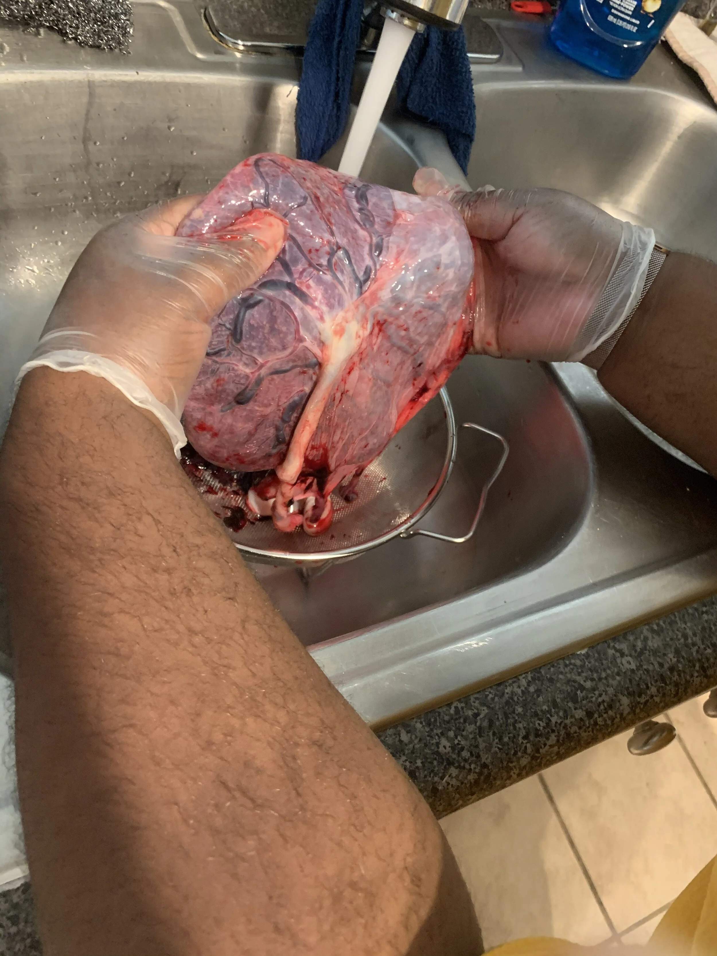 Britt's Placenta.JPG