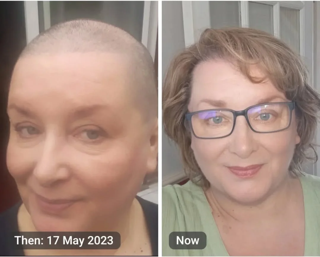 What a difference 3 years can make.
In 2023 I was going through chemotherapy and facing surgery and radiotherapy

Now in 2026 I got through 
 
So grateful to everyone that supported me and helped me
Now I am able to give back a little 
Love my volunt