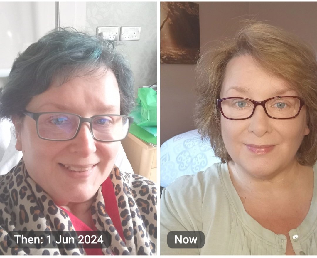 1st June 2024....in for my 2nd surgery.
1st June 2026....a bit more makeup and a bit more hair
So grateful 🧡🧡🧡
#cancerexperience
#cancerconversations
#cancersupport