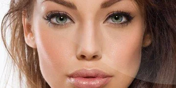 Using filler products can provide added fullness to both the upper and lower lips. LEARN MORE