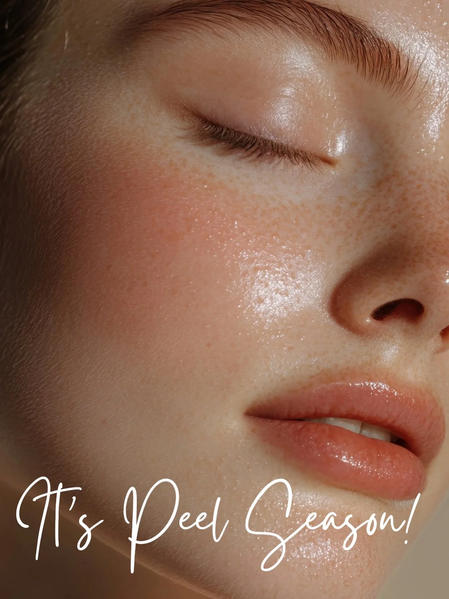 🍁✨ Peel Season is here! ✨🍁

Fall is the perfect time to refresh your skin&mdash;less sun means more healing and brighter results.

Peels don&rsquo;t mean &ldquo;peeling like an orange.&rdquo; They&rsquo;re gentle, effective, and the perfect reset f