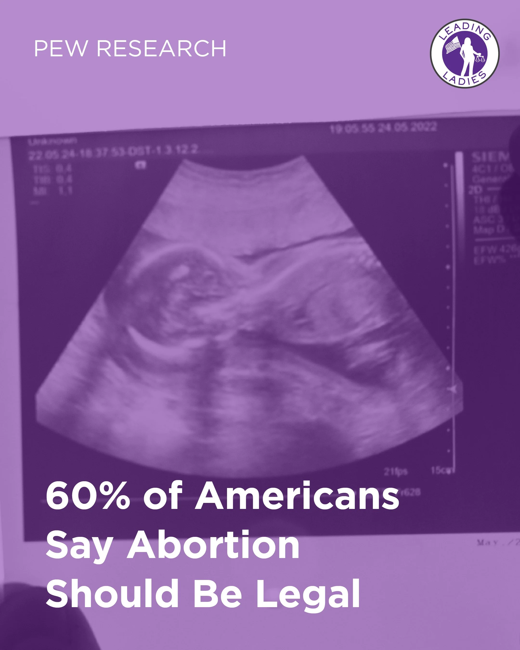 Pew Research: 60% of Americans Say Abortion Should Be Legal