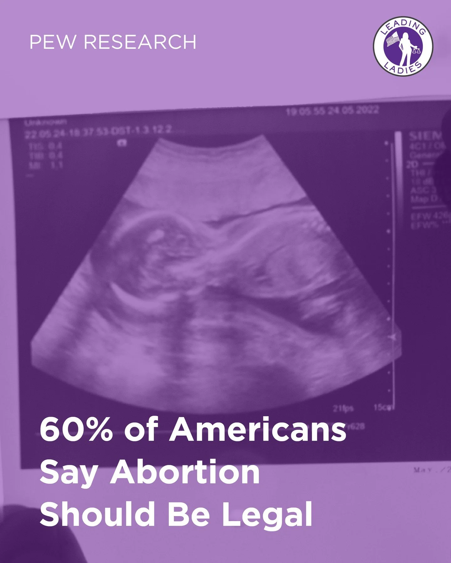 Nearly four years after the Supreme Court overturned Roe v. Wade, a new Pew Research Center survey makes one thing clear: the American people have not changed their minds.⁠
⁠
A 60% majority of U.S. adults say abortion should be legal in all or most c
