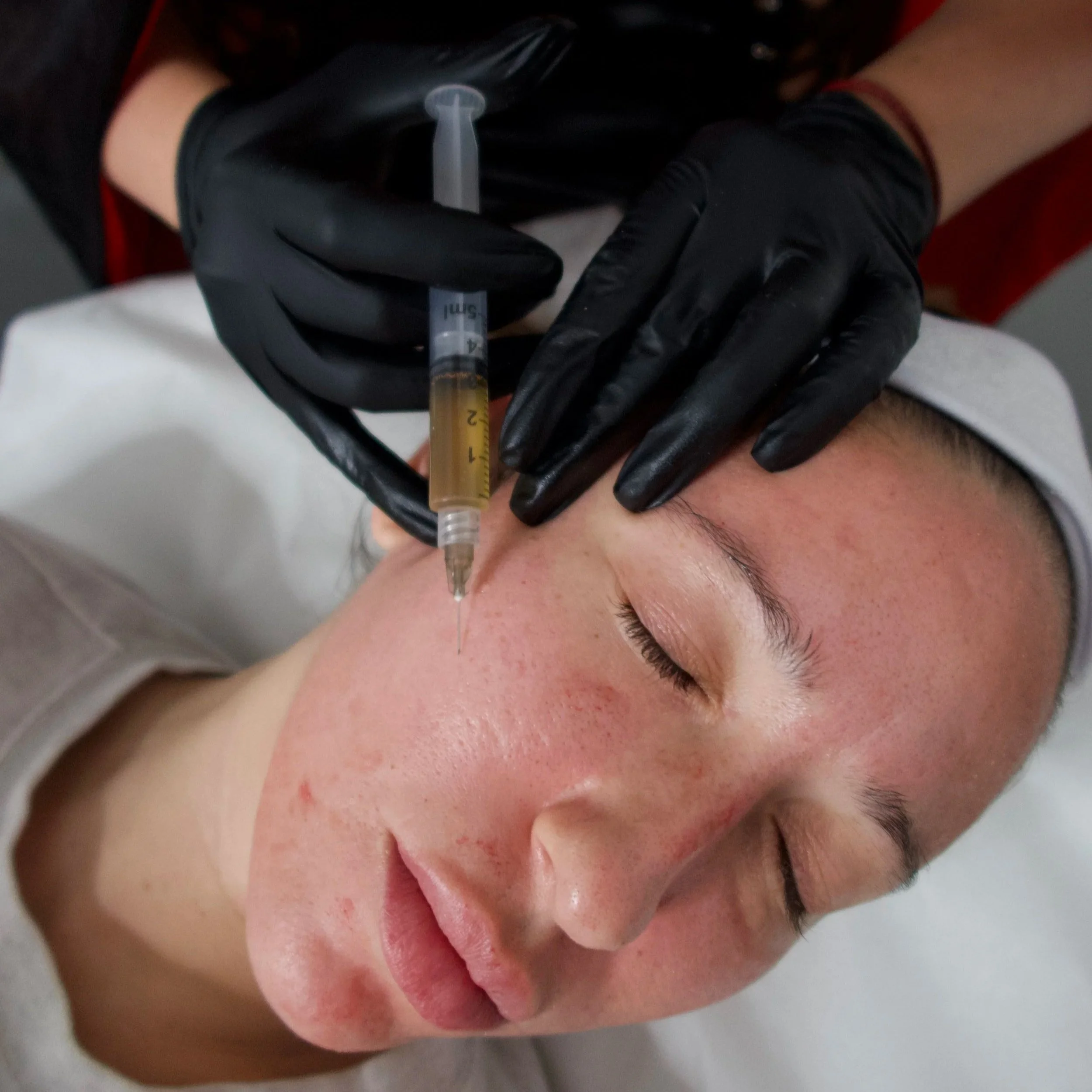 A Guide to Collagen-Stimulating Treatments