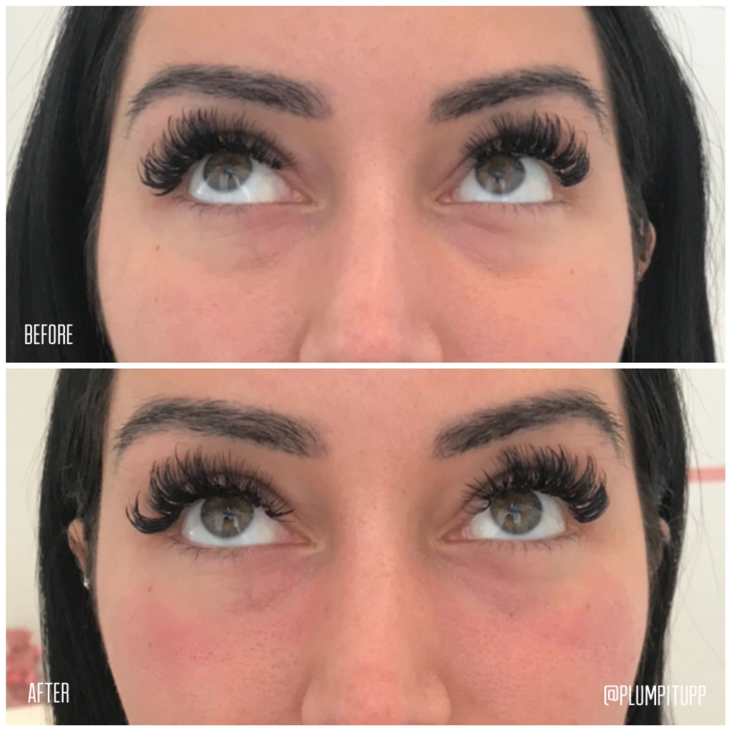derma-fillers-39.jpg