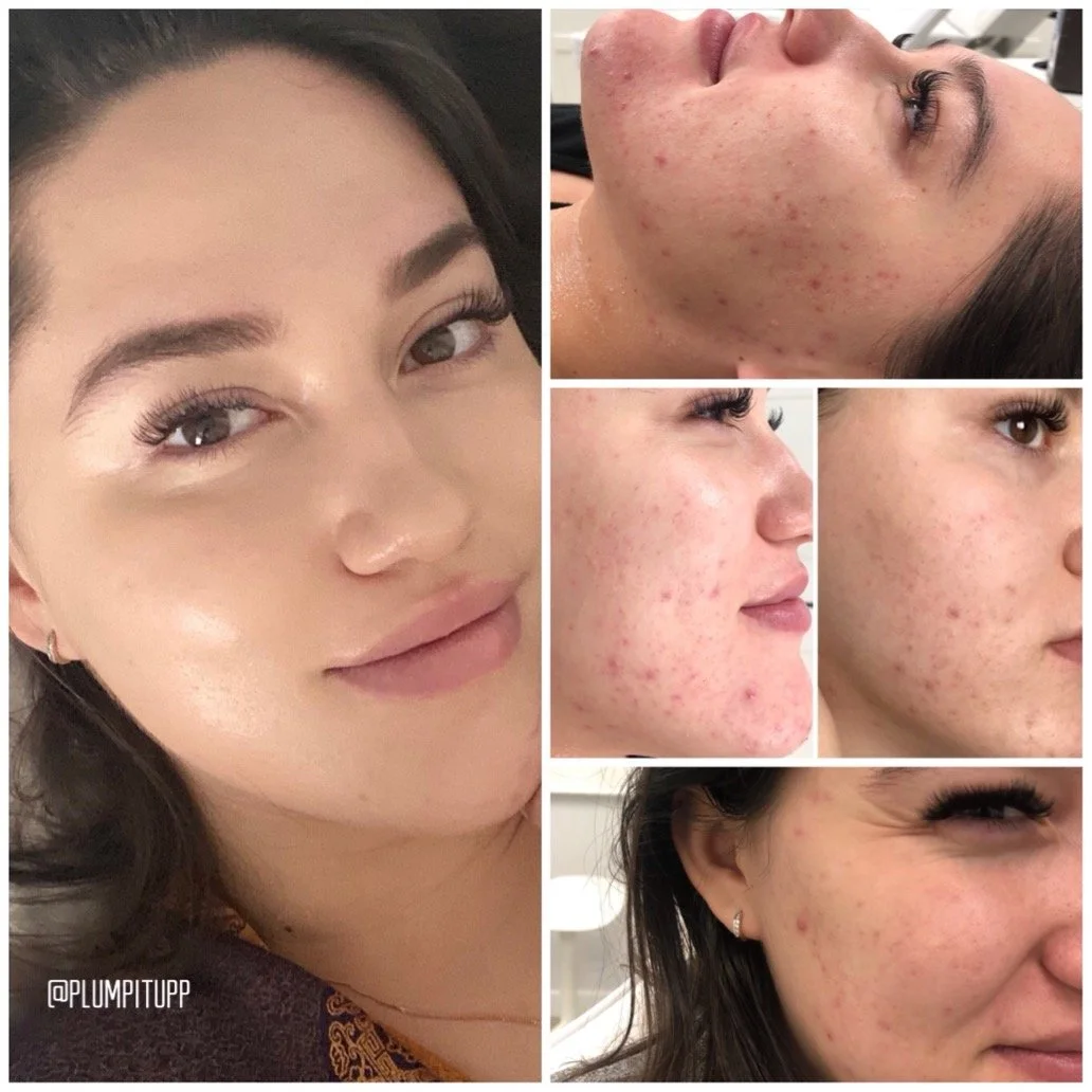 facial-treatments-3.JPG