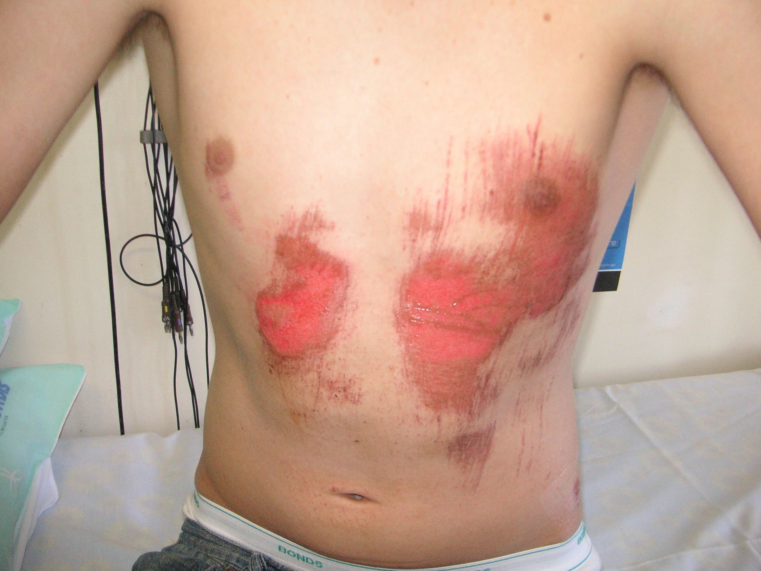 WNBMC Patient 2 Nov 2006-1.JPG