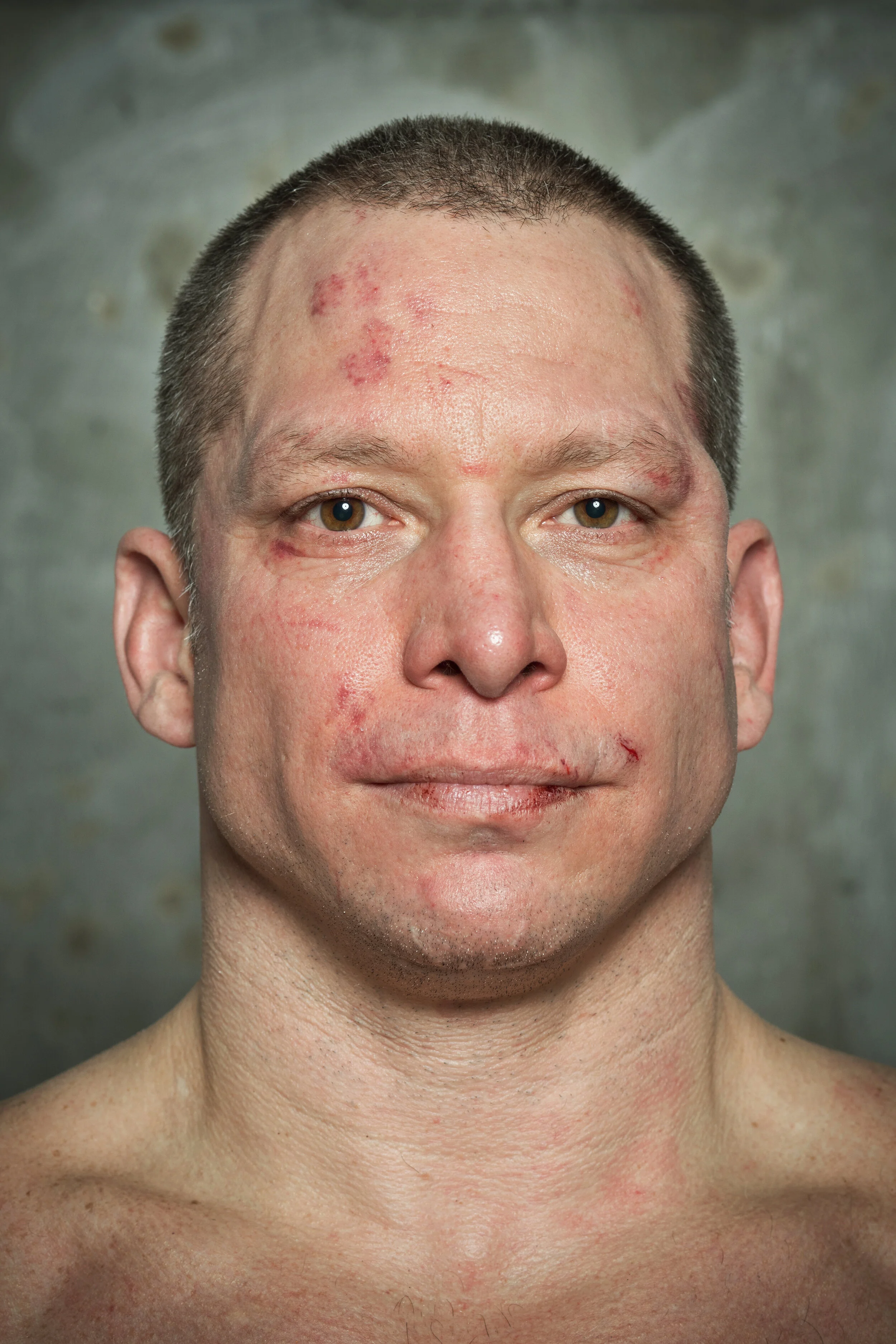  Bill Fraser, after. 