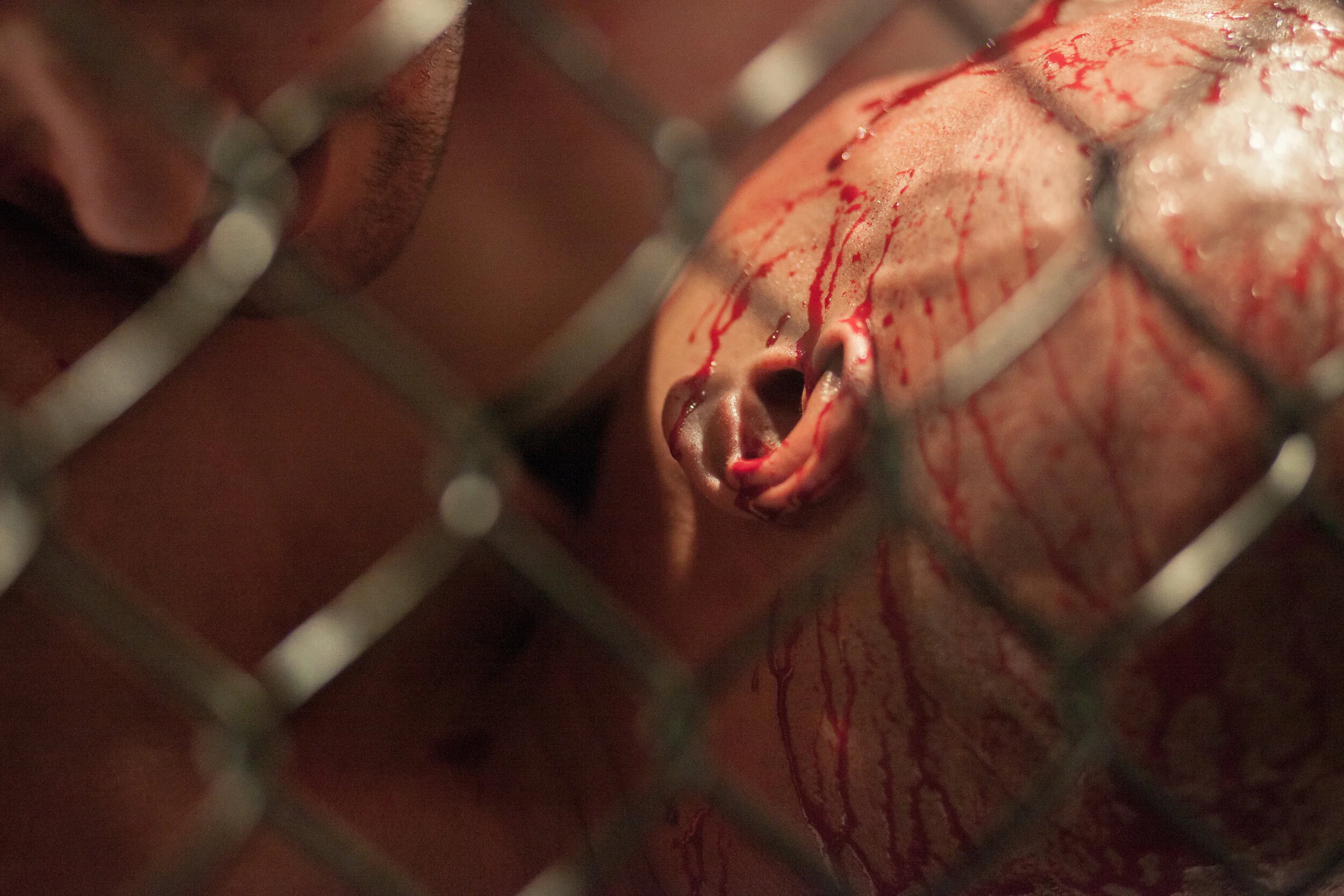  A face wound. 