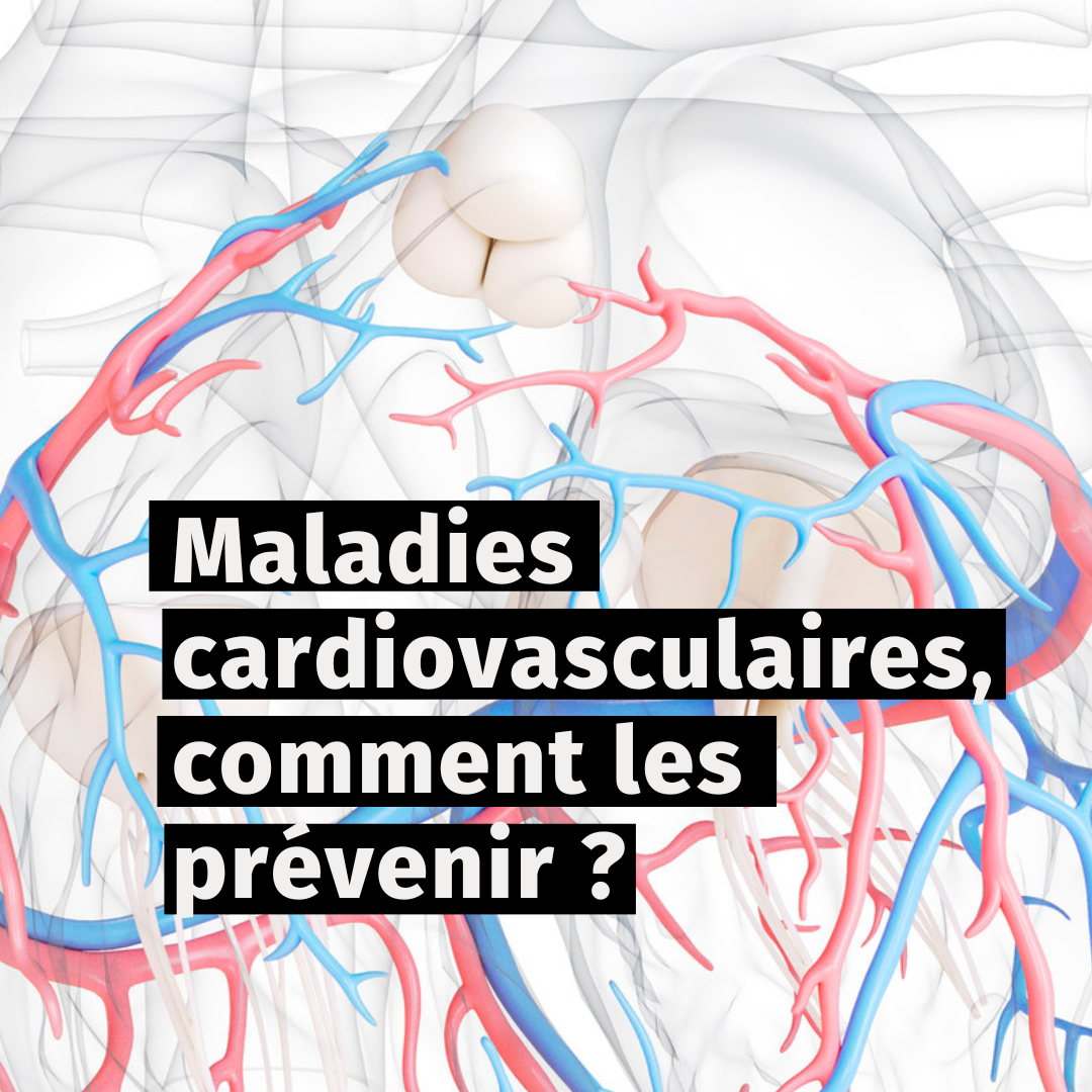 Maladies cardiovasculaires, comment les prévenir ? 