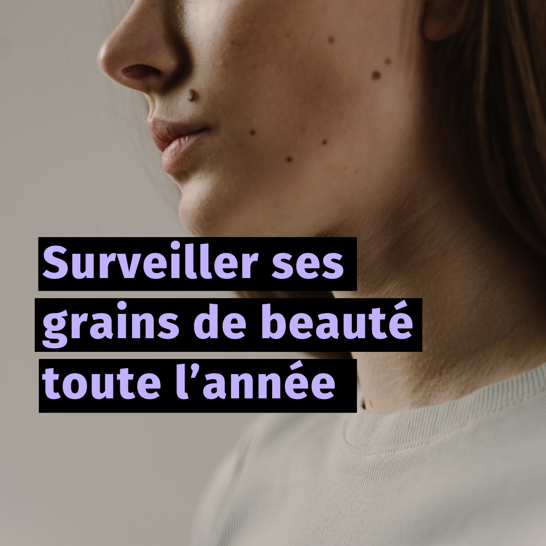Surveiller ses grains de beauté toute l’année