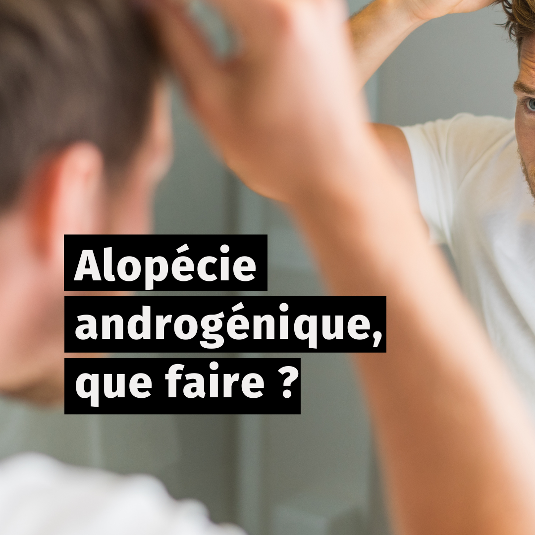 Alopécie androgénique, que faire ?